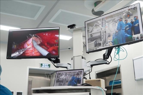 Việc xây dựng và vận hành mạng lưới phẫu thuật robot từ xa còn thể hiện xu hướng chuyển đổi số mạnh mẽ trong lĩnh vực y tế, đồng thời tận dụng hạ tầng viễn thông, công nghệ số và trí tuệ nhân tạo để kết nối các trung tâm y tế, mở rộng khả năng đào tạo, hội chẩn và hỗ trợ kỹ thuật từ xa. (Ảnh: Ánh Tuyết/TTXVN)
