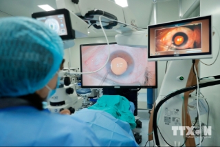 Trung tâm Mắt công nghệ cao Tâm Anh đầu tư hệ thống 2 máy Visumax 800 mổ SMILE Pro, tích hợp hệ thống trang thiết bị được đầu tư đồng bộ mang lại trải nghiệm tốt các phẫu thuật tật khúc xạ cho bệnh nhân. (Ảnh: Minh Quyết/TTXVN)